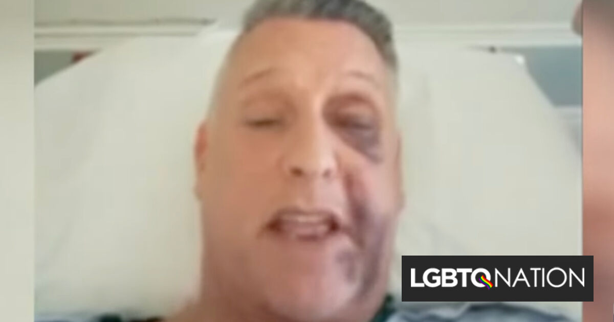 Hombre gay brutalmente golpeado por atacantes que gritan insultos anti-LGBTQ+