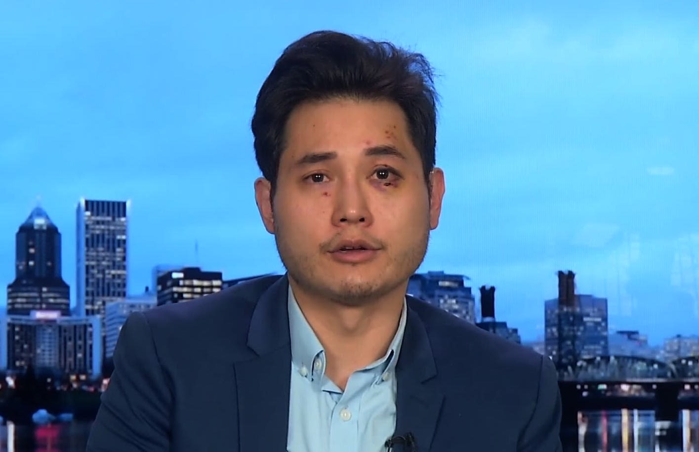 El derechista gay que ataca a los izquierdistas acaba de perder su demanda que decía que los izquierdistas lo atacaban a él