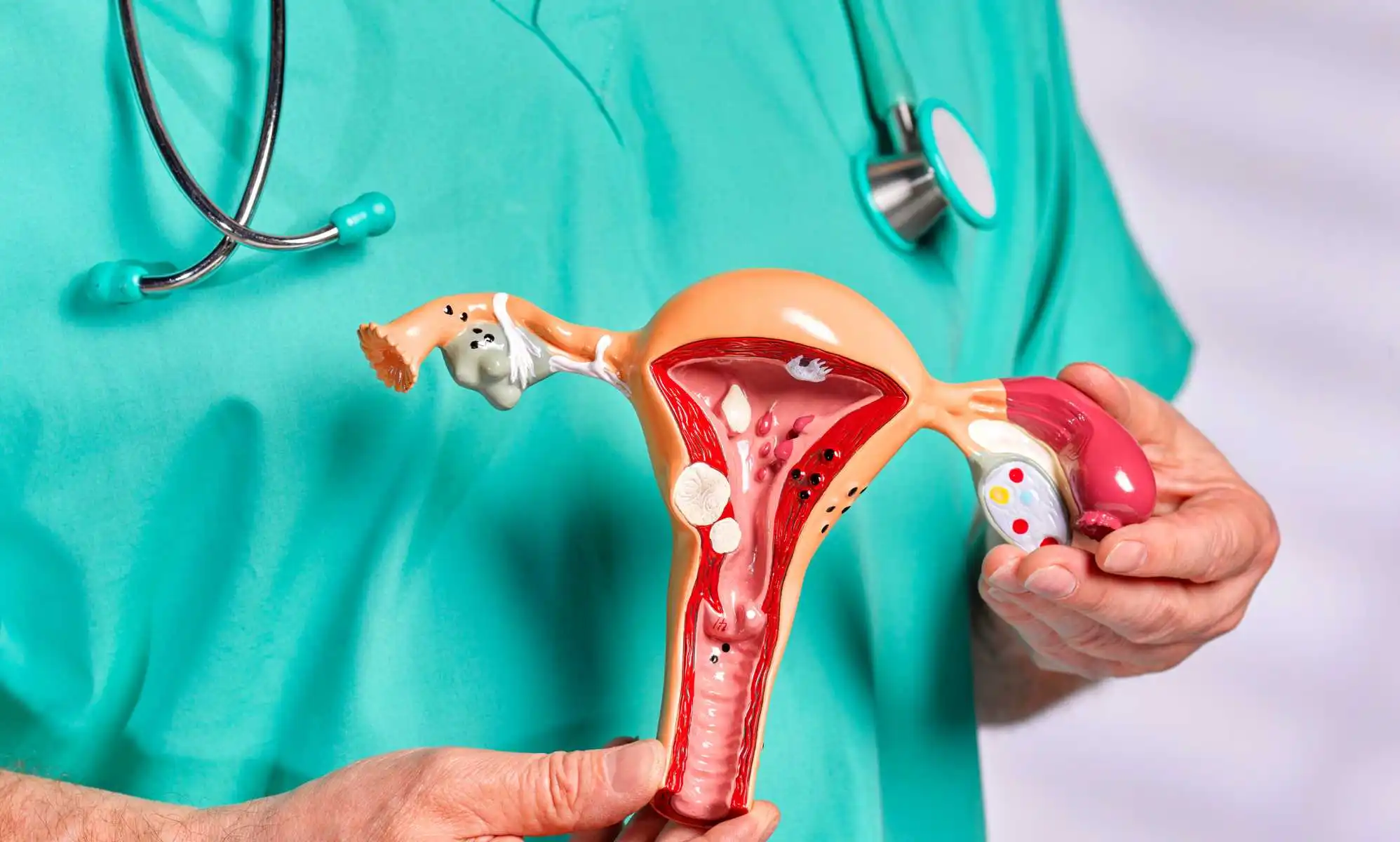 Gynecologist holding teaching tool model of women