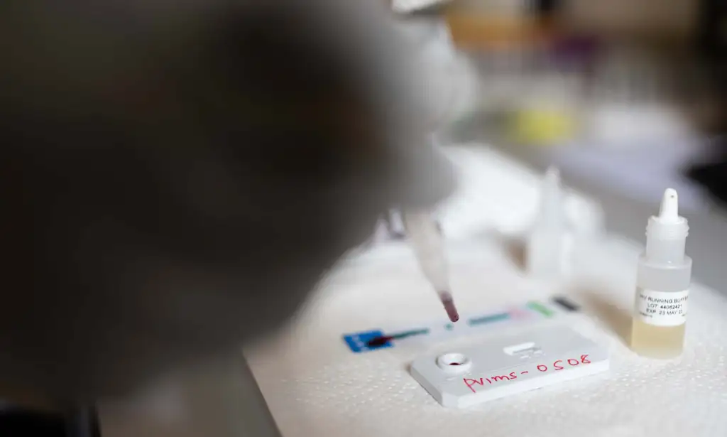 Uganda ha sido un país líder en investigación sobre prevención del VIH