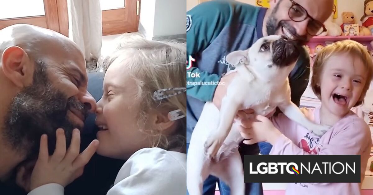 20 familias rechazaron a una bebé con síndrome de Down hasta que un soltero gay la adoptó