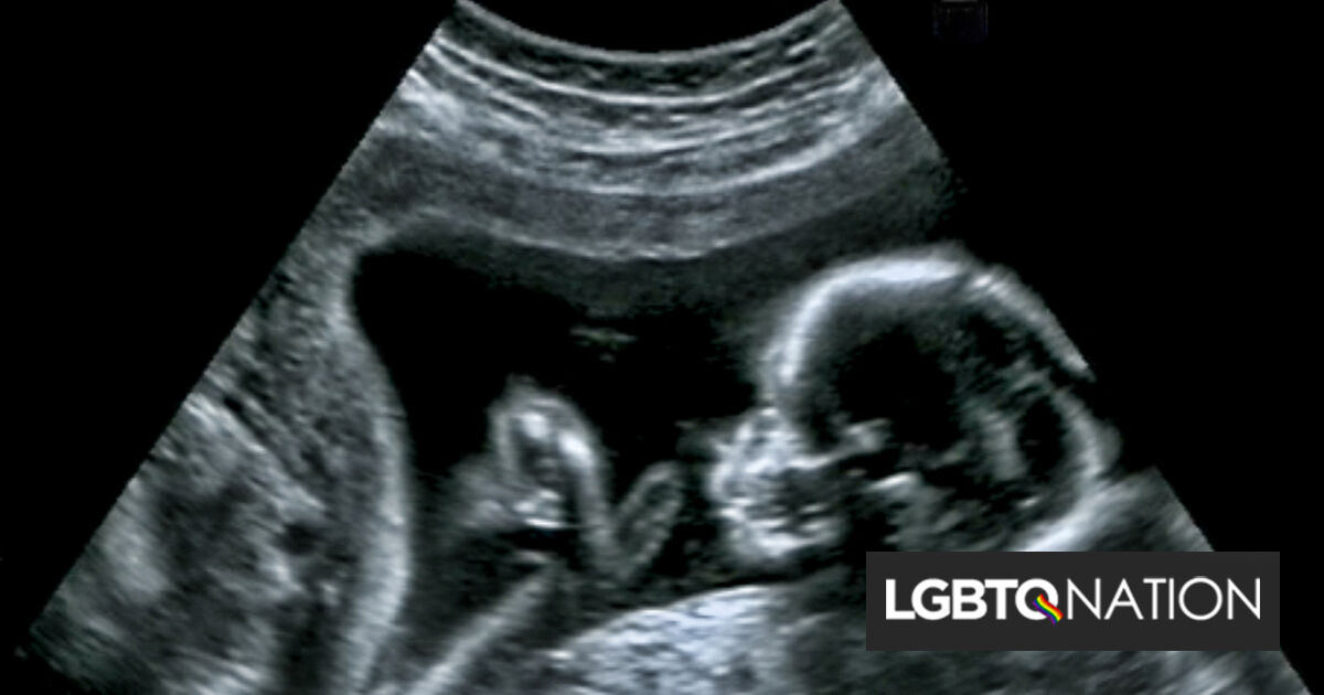 La última teoría de la conspiración de la derecha son los fetos queer