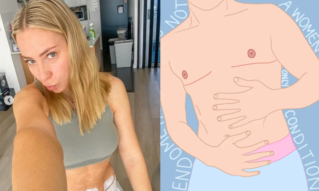 Zahra McDonald has a trans-inclusive social media account to raise awareness of endometriosis. (@endoitwithzahra/Instagram)