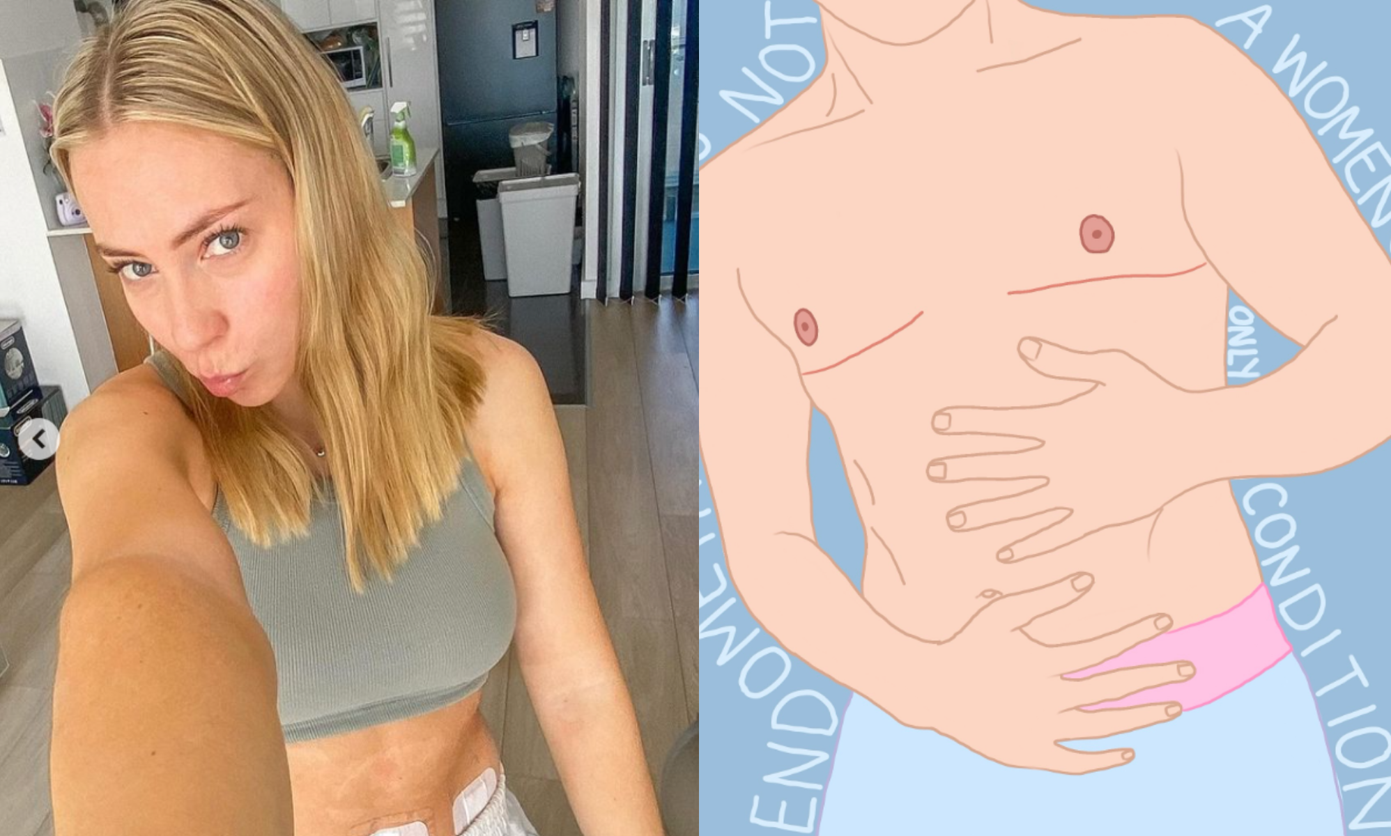 Zahra McDonald has a trans-inclusive social media account to raise awareness of endometriosis. (@endoitwithzahra/Instagram)