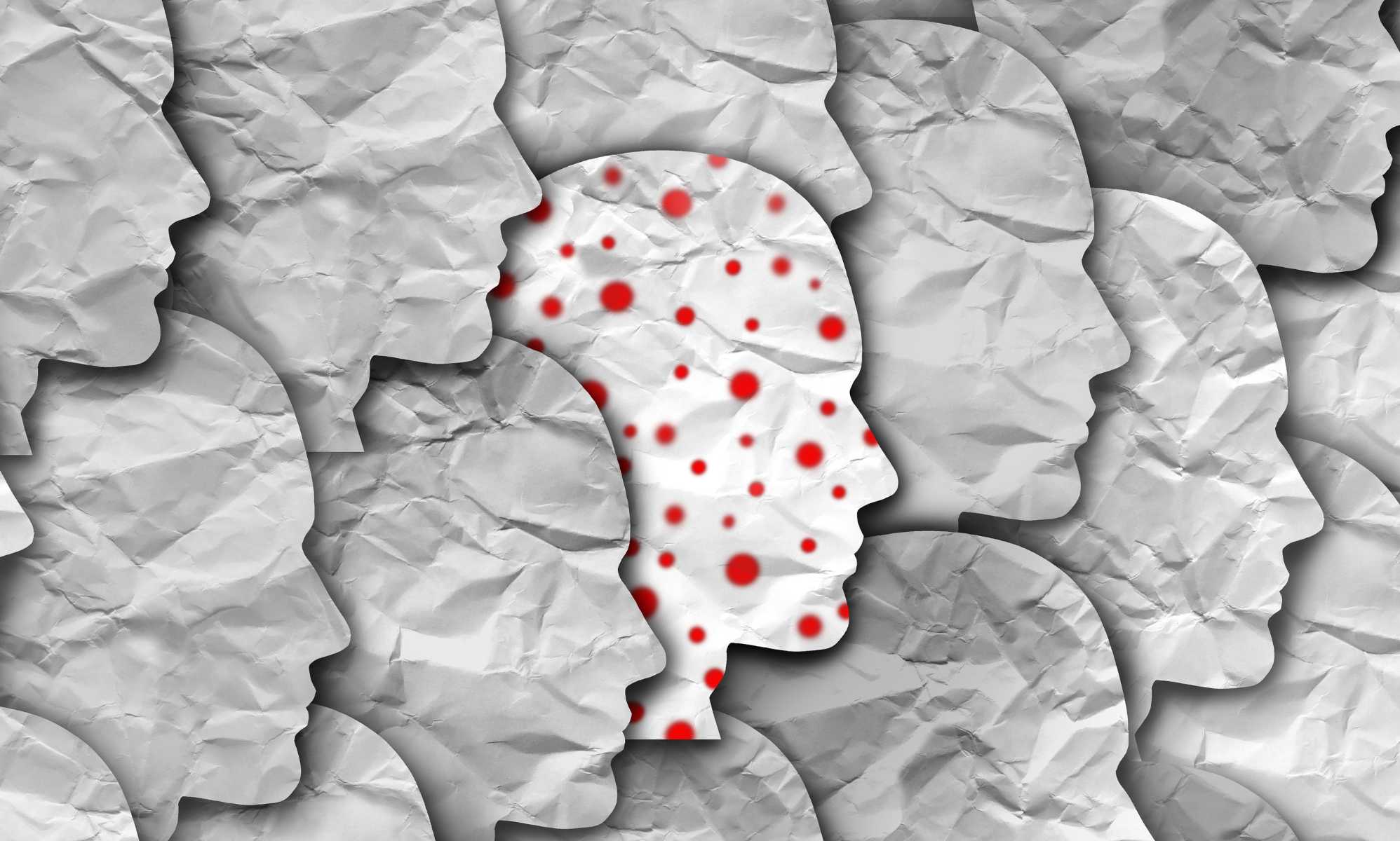 Mpox infectious disease outbreak as a contagious infection as blisters and leisons on the skin representing transmission of an infected person in a population.