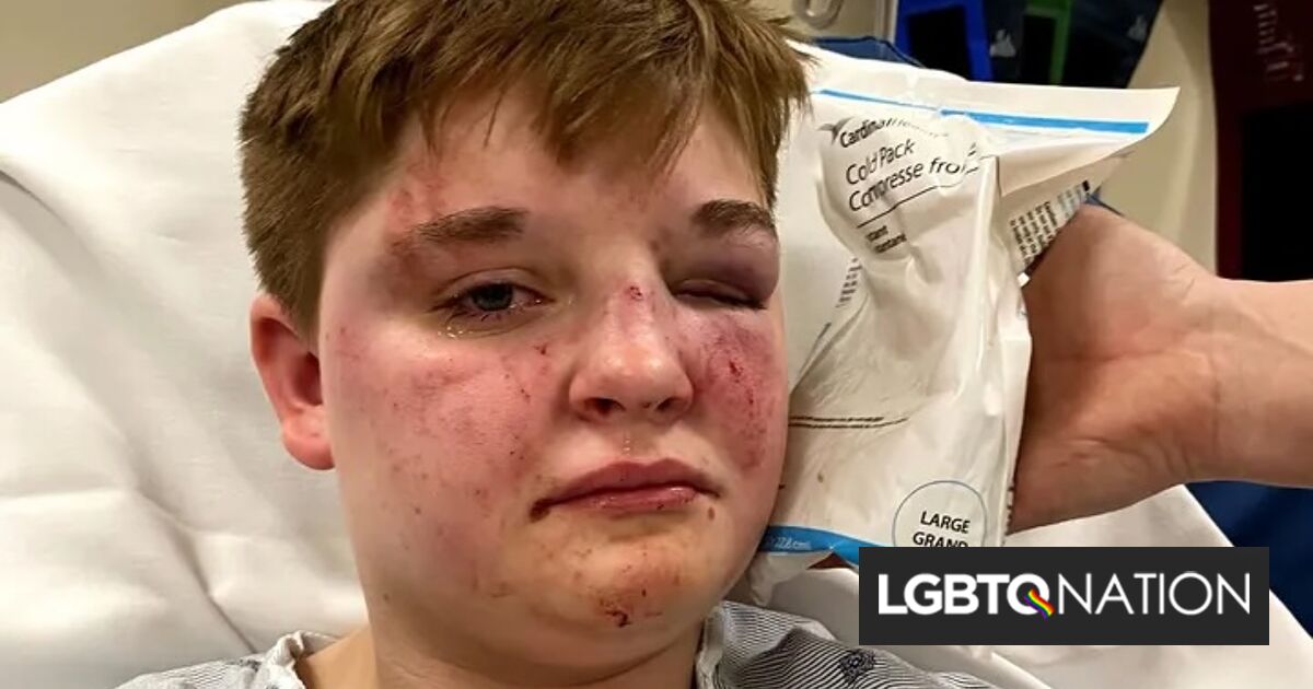 Teen lesbiana brutalmente golpeada al inconsciente y robada en McDonalds