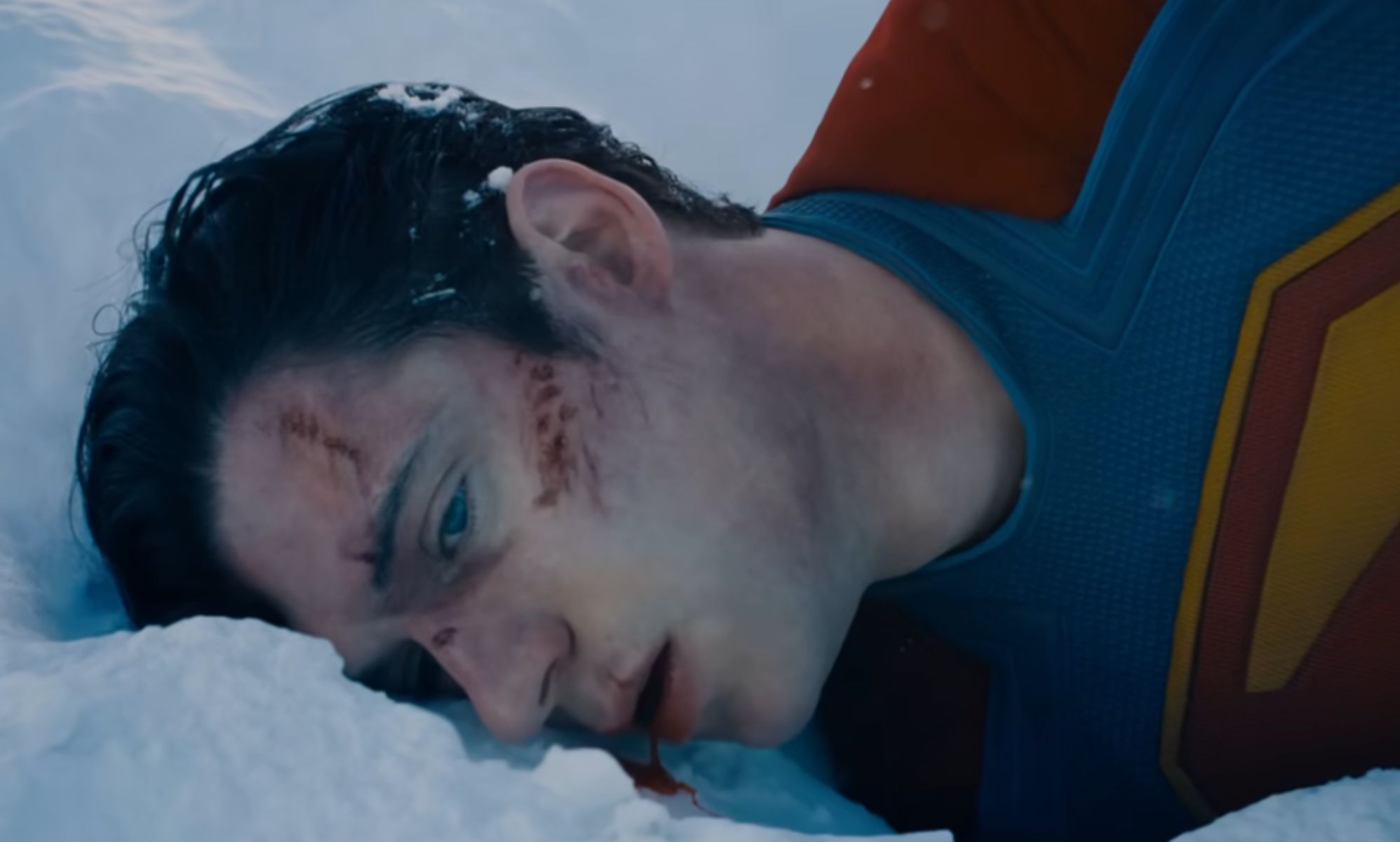 David Corenswet, as Superman, laying in the snow with prosthetic injuries on his face.