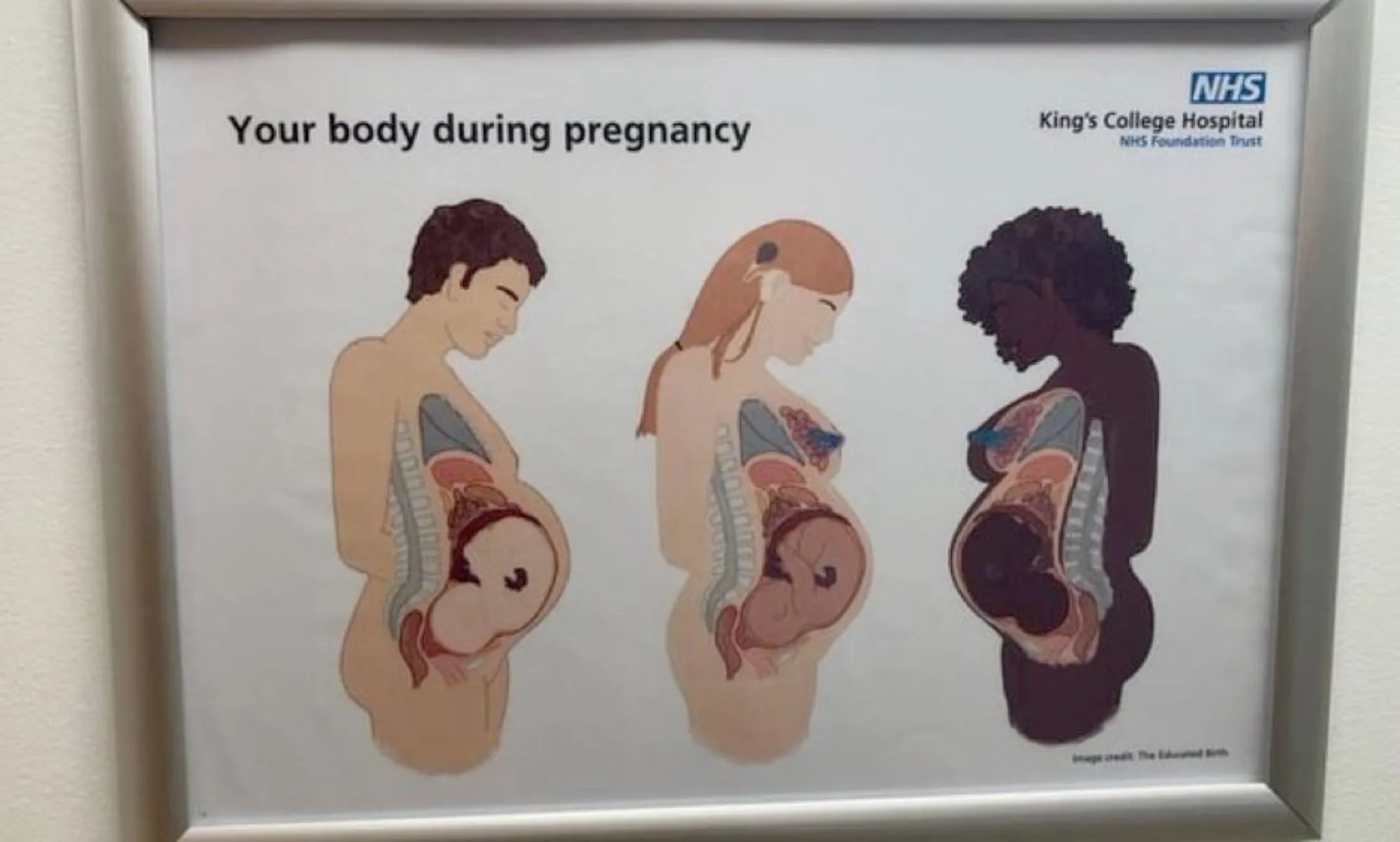 A fake NHS diagram on a wall showcasing three pregnant people