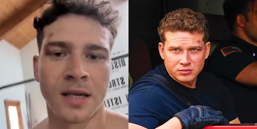 9-1-1: Oliver Stark está sudoroso, en topless y 'emocionado por profundizar' en la bisexualidad de Buck