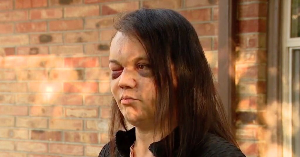 Mujer trans viciosamente latidos por la mafia gritando insultos. Ella ya no se siente segura en Estados Unidos.