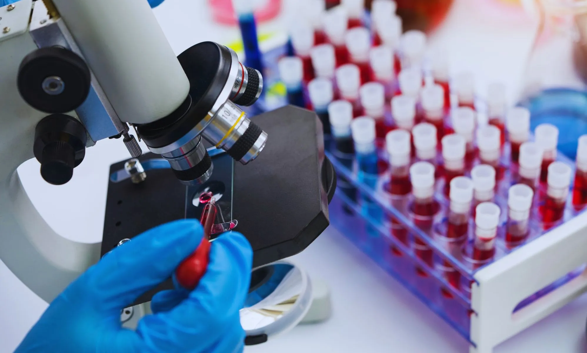 A person looking at a blood sample under a microscope.