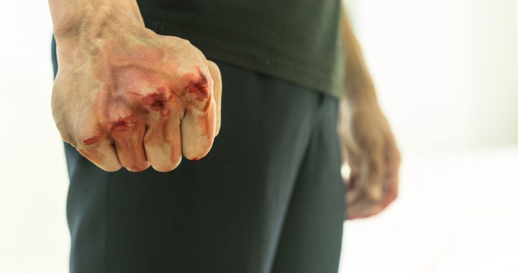 Padre gay golpea a comentarista de derecha después de haber sido engañado para una entrevista homofóbica