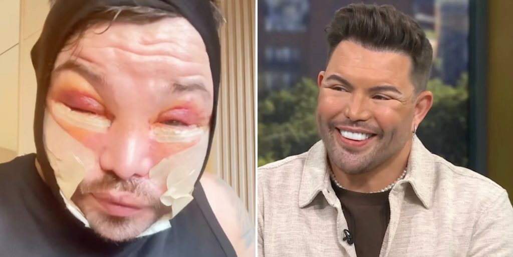 Bobby Norris critica el 'juicio' de un extraño en un video vendado después de un lavado de cara